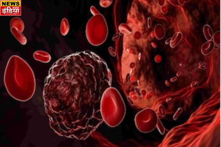 Big disclosure in Lancet report, cases of blood cancer are increasing among Indian youth