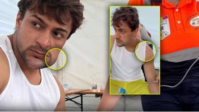 Khatron ke khiladi 14: Shaleen Bhanot became the victim of 200 scorpions! The map of the face got spoiled