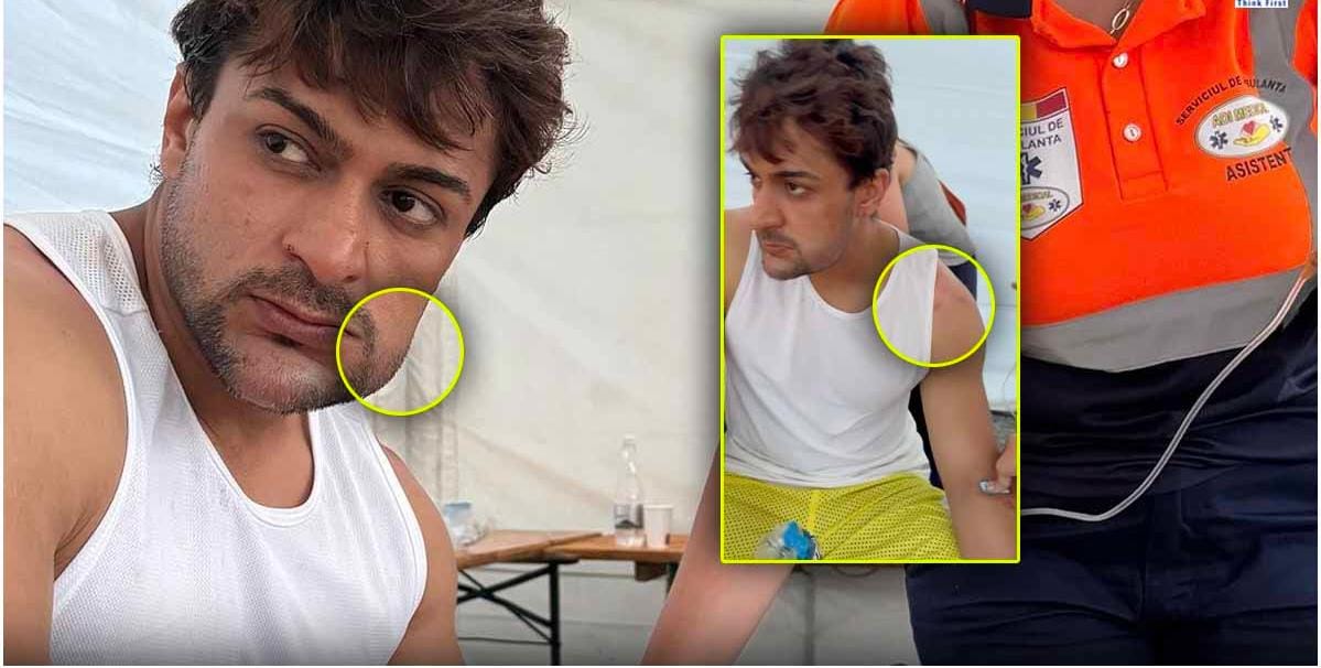 Khatron ke khiladi 14: Shaleen Bhanot became the victim of 200 scorpions! The map of the face got spoiled