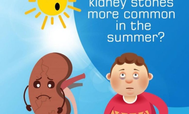 Kidney Stone Causes In Summer: Kidney Stone Causes In Summer, Know How To Avoid