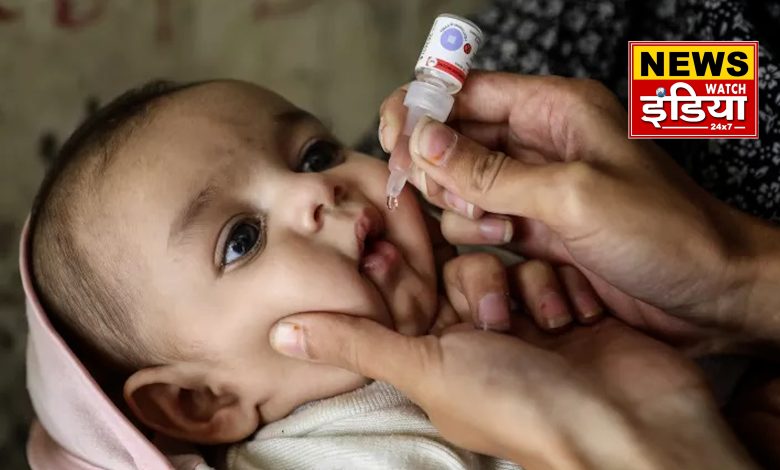 Polio case in Meghalaya, know about Vaccine Derived Polio and need for vigilance