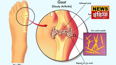 Danger of high uric acid, include these things in your diet and get relief