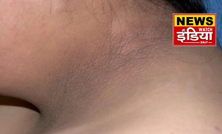 Black lines and moles on the neck, do not ignore them, it may be a sign of a serious disease