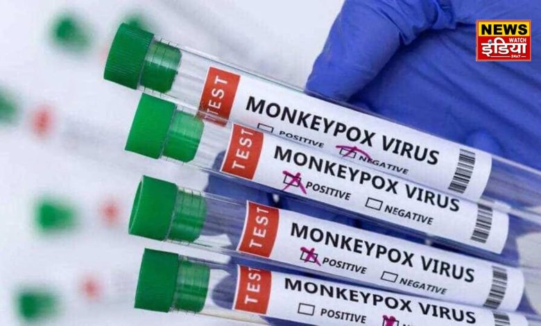 Mpox is spreading in India, what is the vaccine for this infection? Know here all the important facts related to this