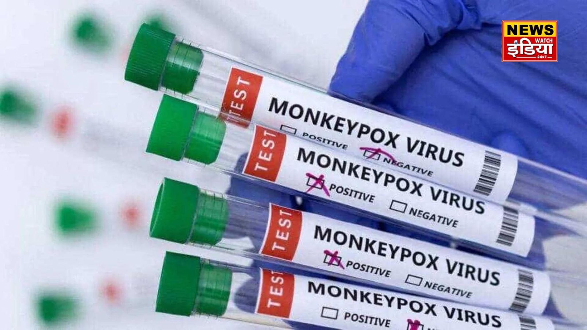 Mpox is spreading in India, what is the vaccine for this infection? Know here all the important facts related to this