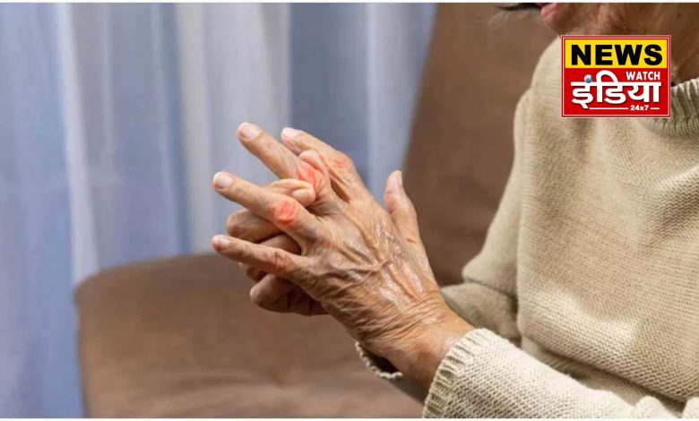 Dehradun: Arthritis patients increased in winter, doctors' advice- you will get relief with alertness and caution