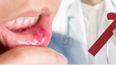 Oral Cancer: Shocking revelation in new study, non-smokers are also becoming victims of this dangerous cancer