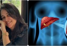 Dipika Kakar Health: Deepika Kakar informed about liver tumor, know the symptoms and precautions of liver cancer