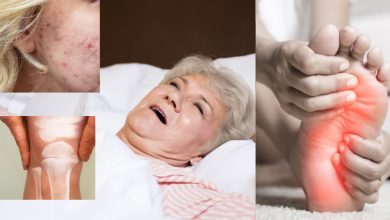 Signs of vitamin D deficiency are also visible on the skin and feet, it is important to identify it in time