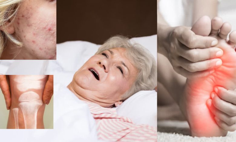 Signs of vitamin D deficiency are also visible on the skin and feet, it is important to identify it in time