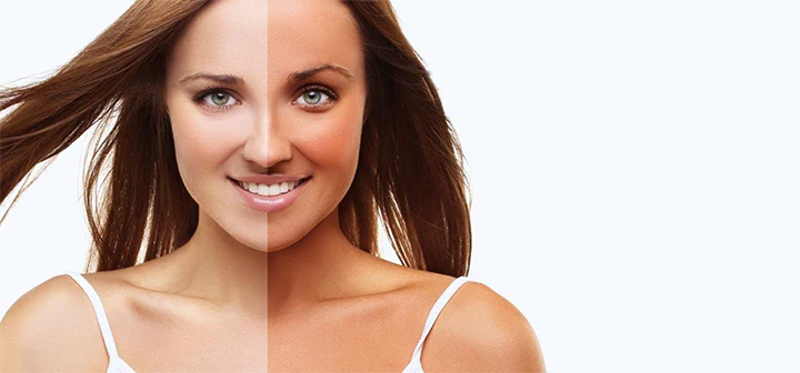 Say goodbye to tanning of hands in summer, these 5 homemade masks will give glowing and radiant skin