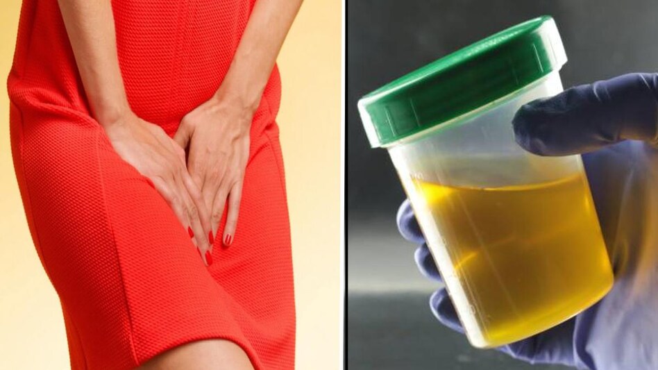 Urine Color Indications: Which color of urine indicates a health hazard?